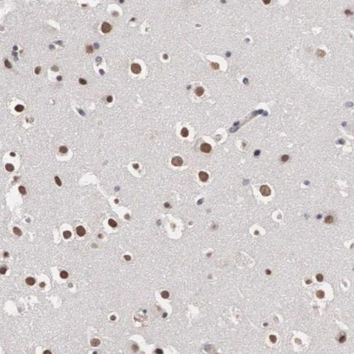 Immunohistochemical staining of human hi