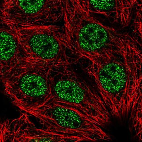 Immunofluorescent staining of human cell