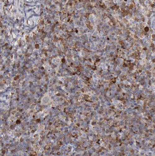 Immunohistochemical staining of human ly