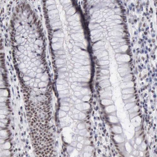 Immunohistochemical staining of human re