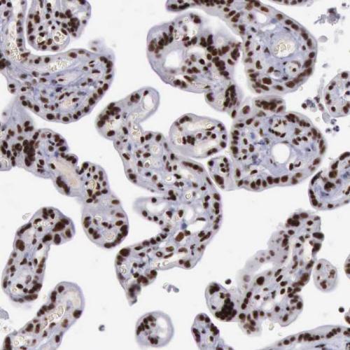 Immunohistochemical staining of human pl