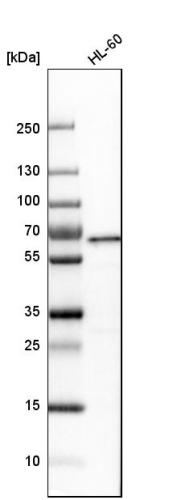 Western blot analysis in human cell line