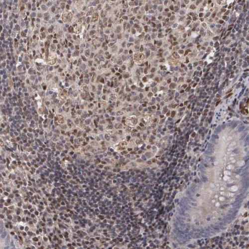 Immunohistochemical staining of human ap