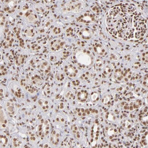 Immunohistochemical staining of human ki