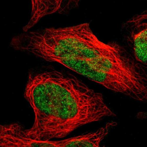Immunofluorescent staining of human cell