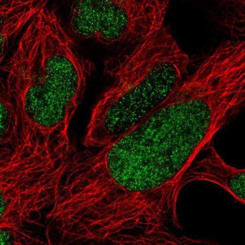 Immunofluorescent staining of human cell