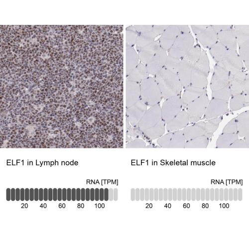 Immunohistochemistry analysis in human l