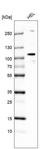Western blot analysis in human cell line