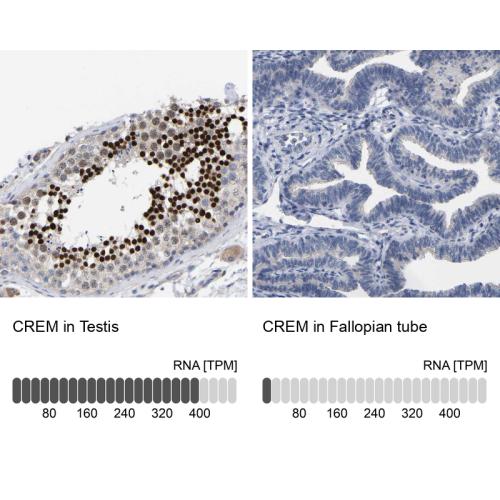 Immunohistochemistry analysis in human t