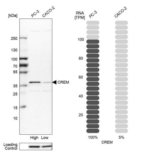 Western blot analysis in human cell line