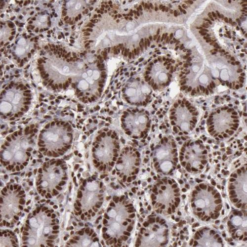 Immunohistochemical staining of human sm