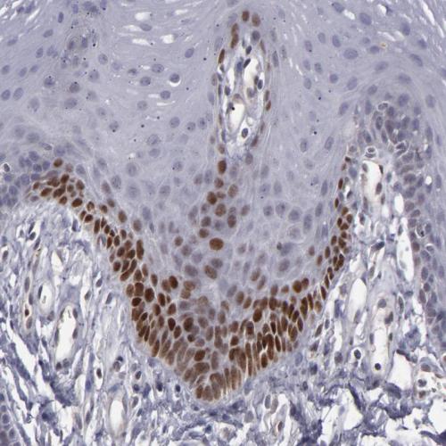 Immunohistochemical staining of human or