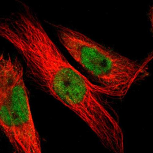 Immunofluorescent staining of human cell