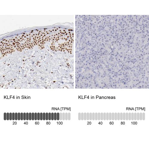 Immunohistochemistry analysis in human s
