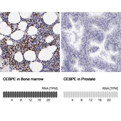 Immunohistochemistry analysis in human b
