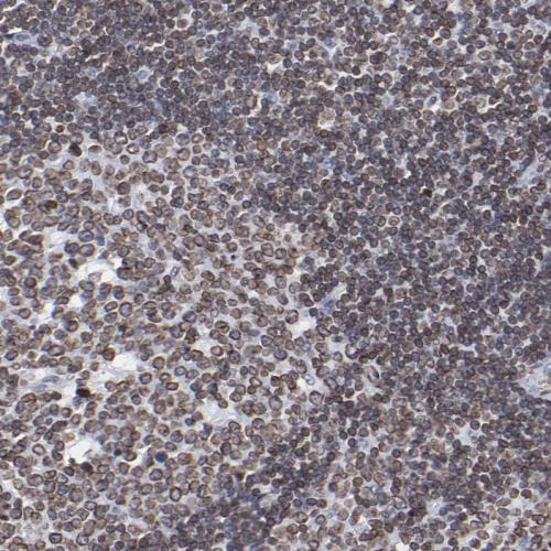 Immunohistochemical staining of human Ly