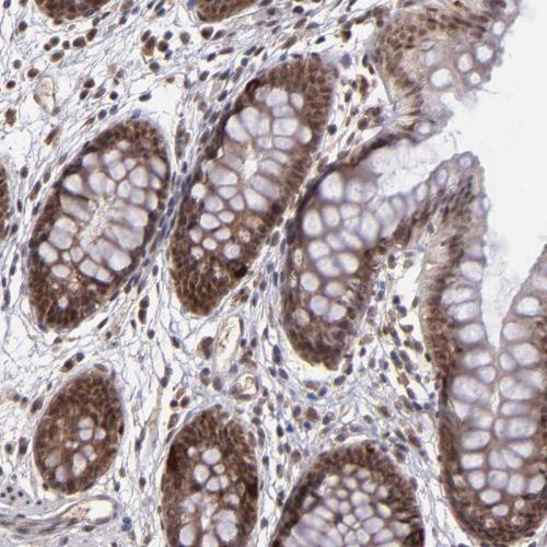 Immunohistochemical staining of human co