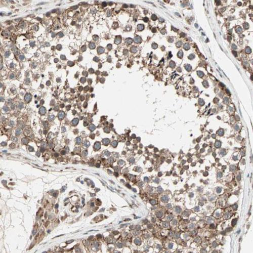 Immunohistochemical staining of human te