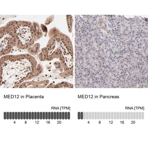 Immunohistochemistry analysis in human p