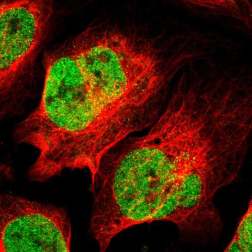 Immunofluorescent staining of human cell