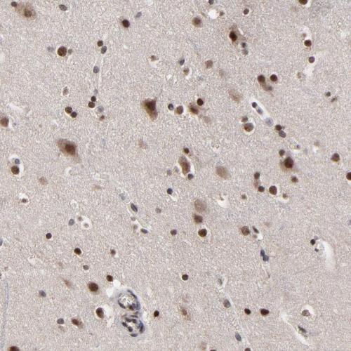 Immunohistochemical staining of human ce