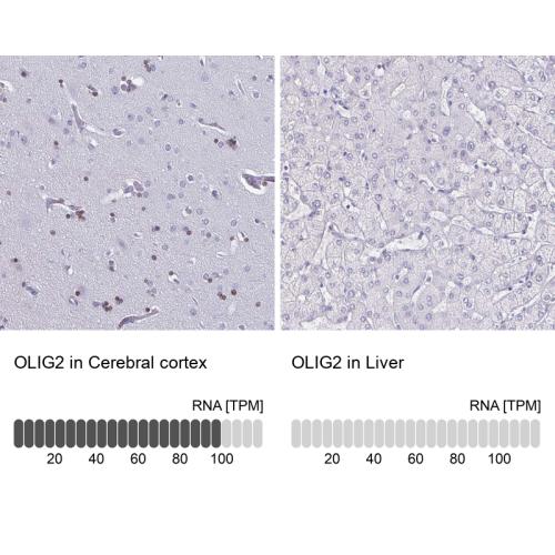 Immunohistochemistry analysis in human c