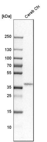 Western blot analysis in human cerebral 