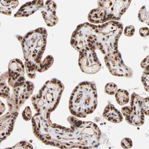 Immunohistochemical staining of human pl