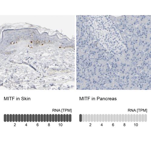 Immunohistochemistry analysis in human s