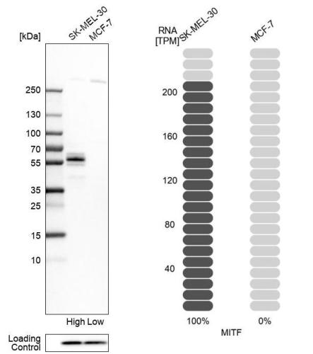 Western blot analysis in human cell line