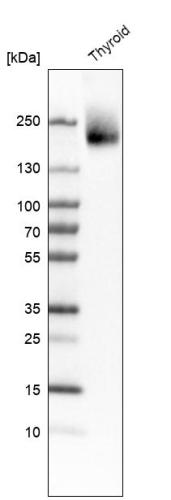 Western blot analysis in human thyroid g