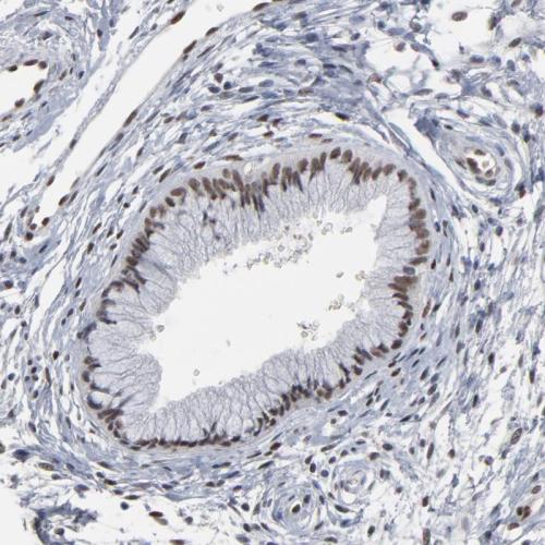 Immunohistochemical staining of human ce