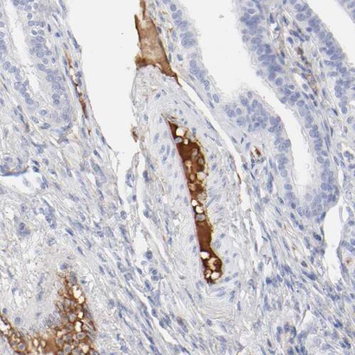 Immunohistochemical staining of human fa