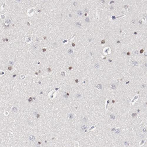 Immunohistochemical staining of human ce