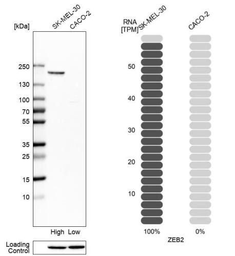 Western blot analysis in human cell line