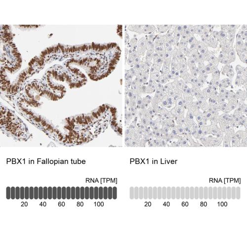 Immunohistochemistry analysis in human f