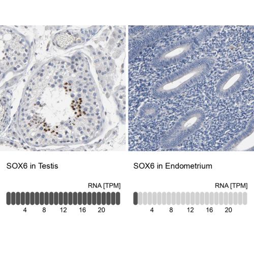 Immunohistochemistry analysis in human t