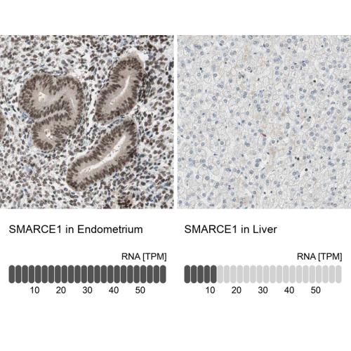 Immunohistochemistry analysis in human e