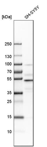 Western blot analysis in human cell line