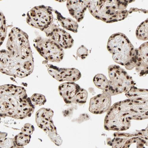 Immunohistochemical staining of human pl