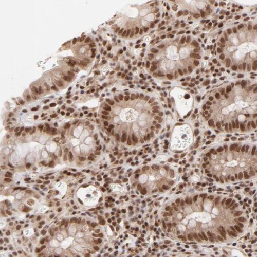 Immunohistochemical staining of human co