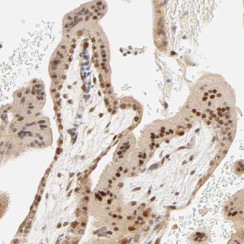 Immunohistochemical staining of human pl