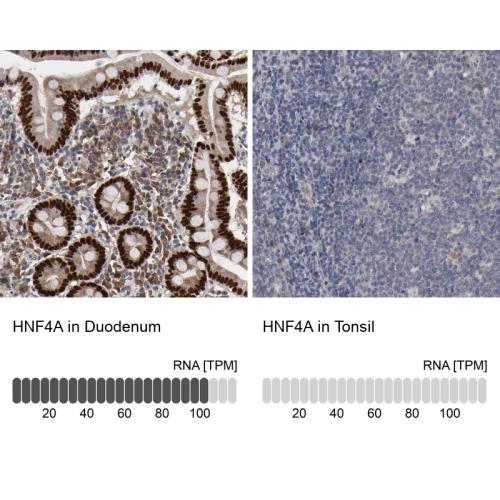 Immunohistochemistry analysis in human d