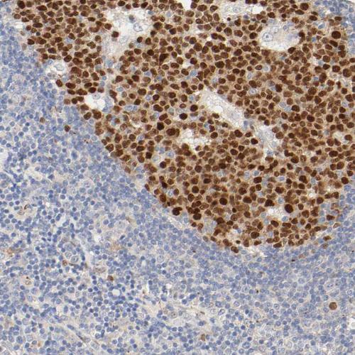 Immunohistochemical staining of human ly