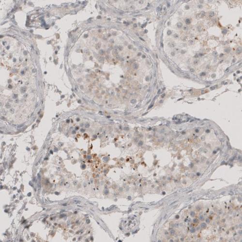 Immunohistochemical staining of human te