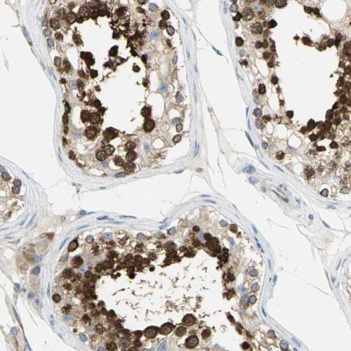 Immunohistochemical staining of human te