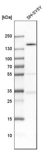 Western blot analysis in human cell line