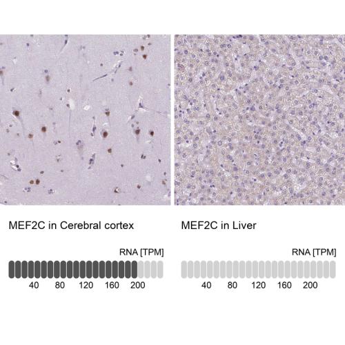 Immunohistochemistry analysis in human c