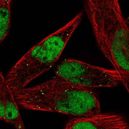 Immunofluorescent staining of human cell