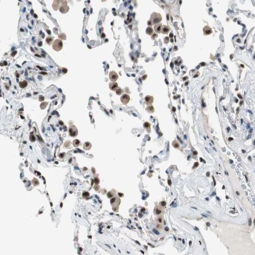Immunohistochemical staining of human lu